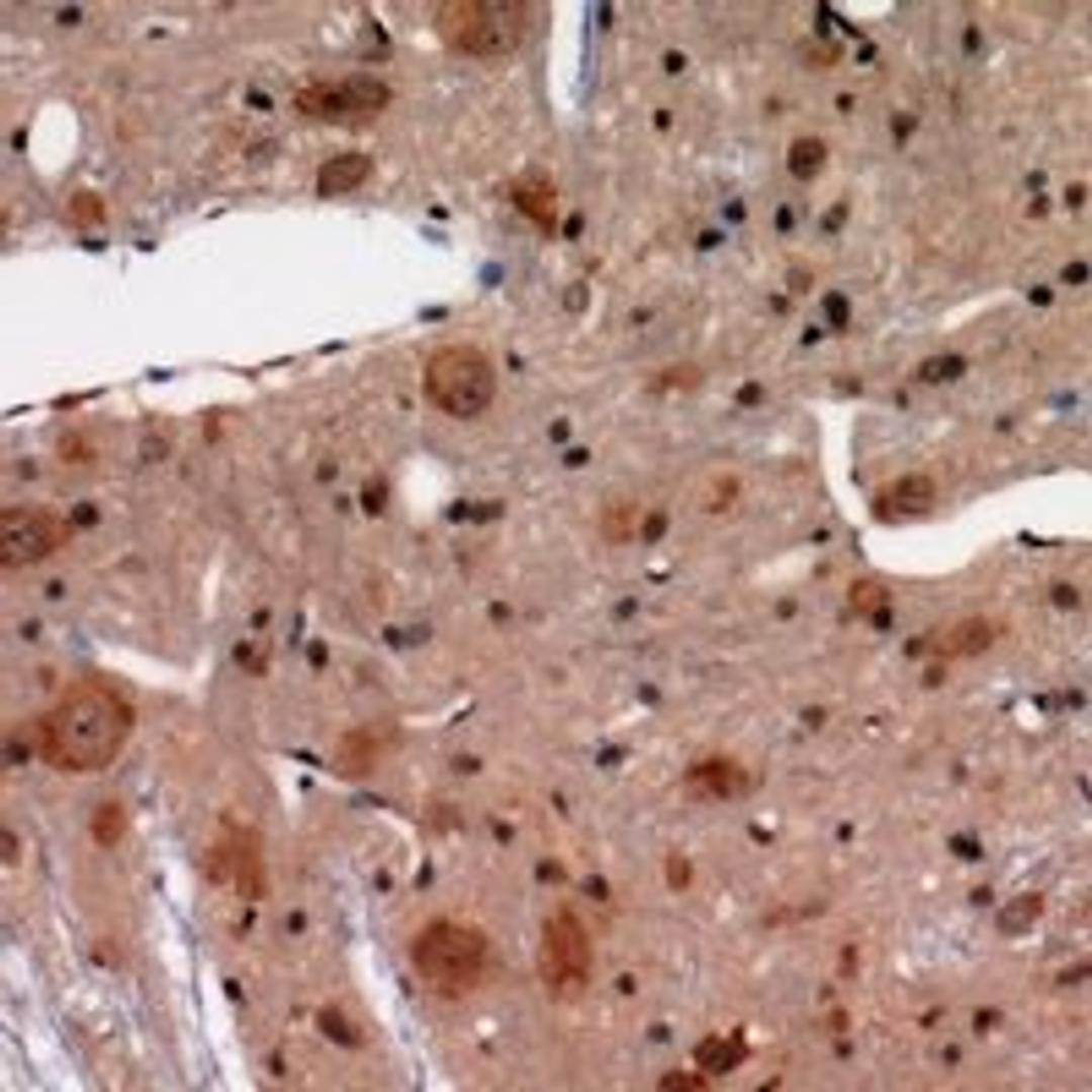 Immunohistochemical staining of human brain tissue using NFASC antibody