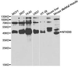 Western blot analysis of extracts of various cell lines using NFKBIB antibody