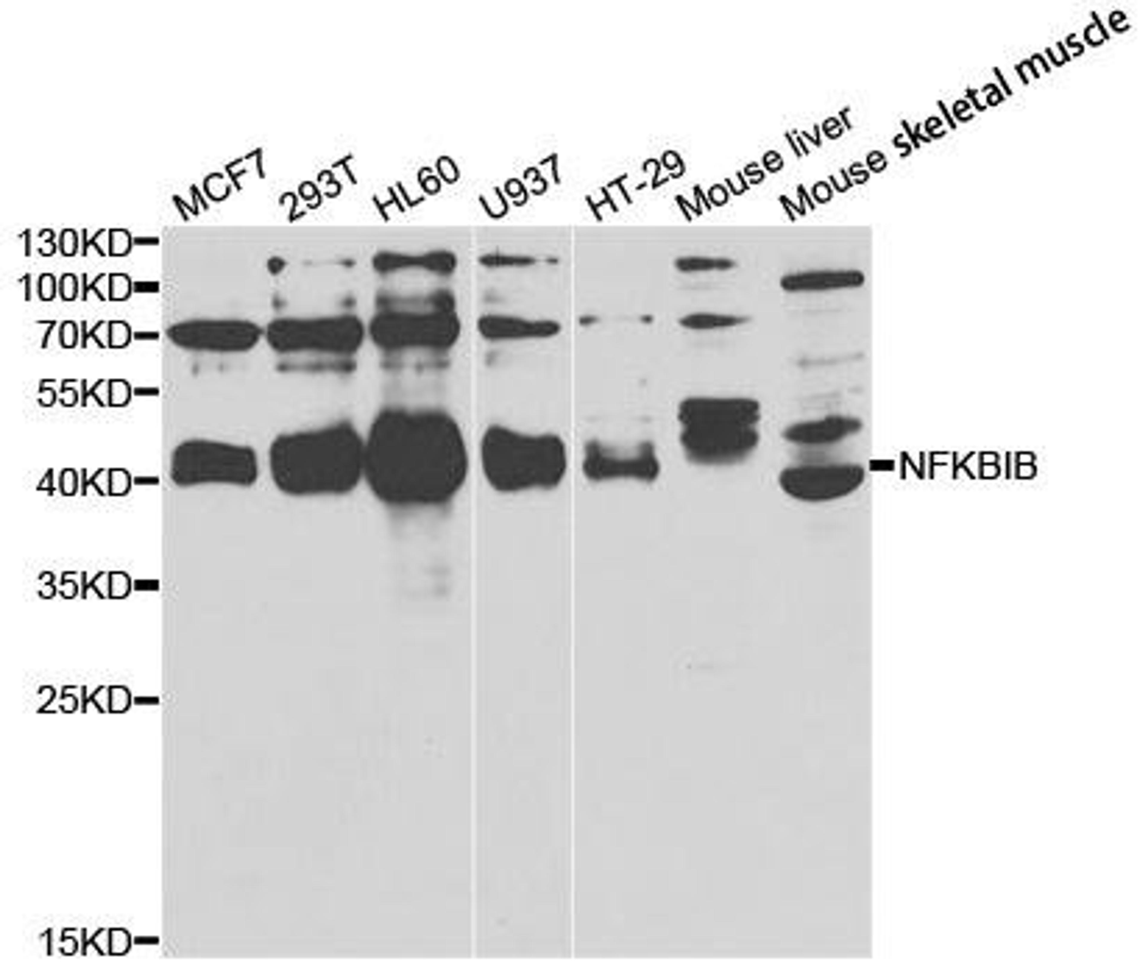 Western blot analysis of extracts of various cell lines using NFKBIB antibody