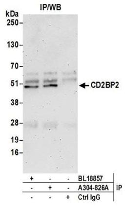 Detection of human CD2BP2 by western blot of immunoprecipitates.