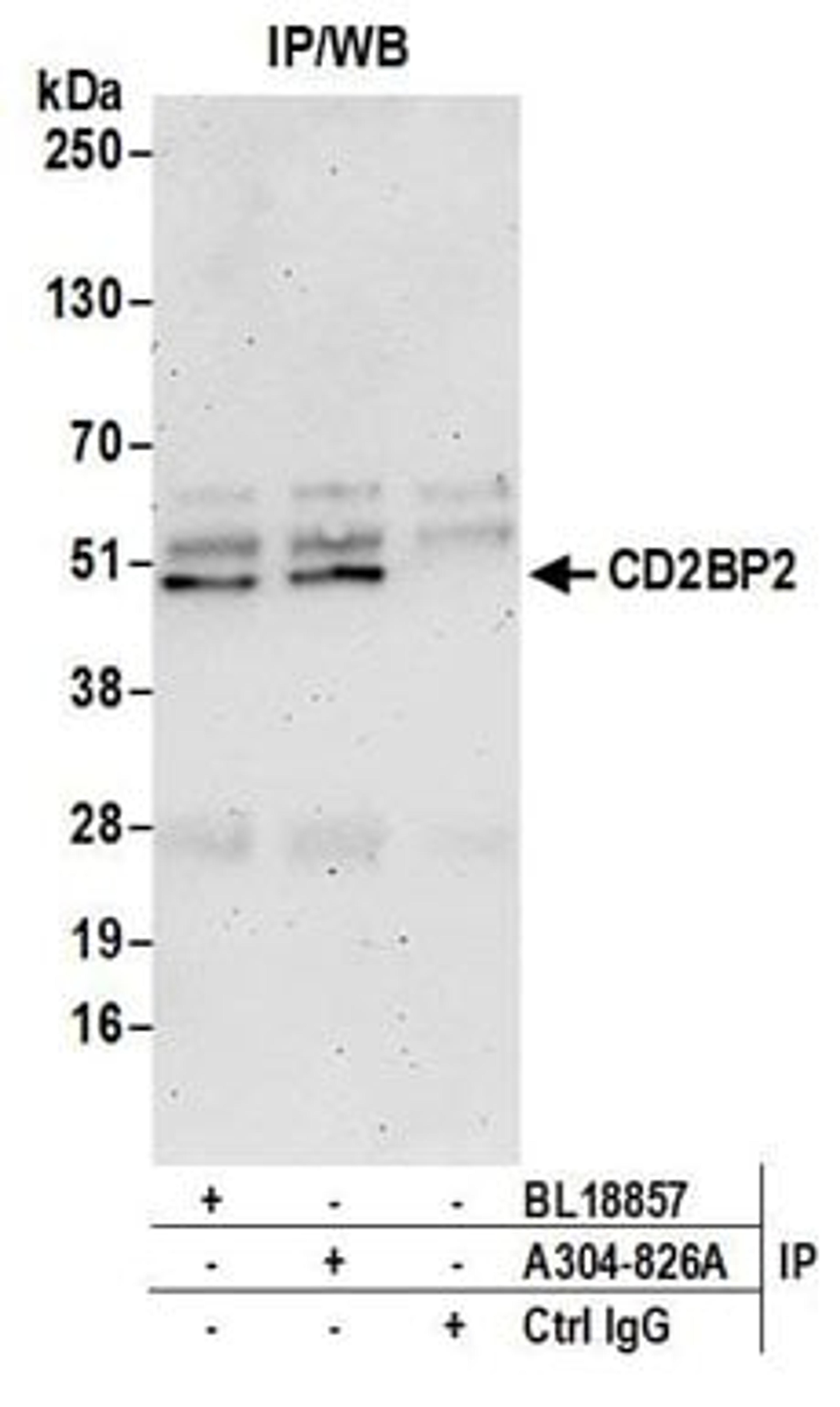 Detection of human CD2BP2 by western blot of immunoprecipitates.