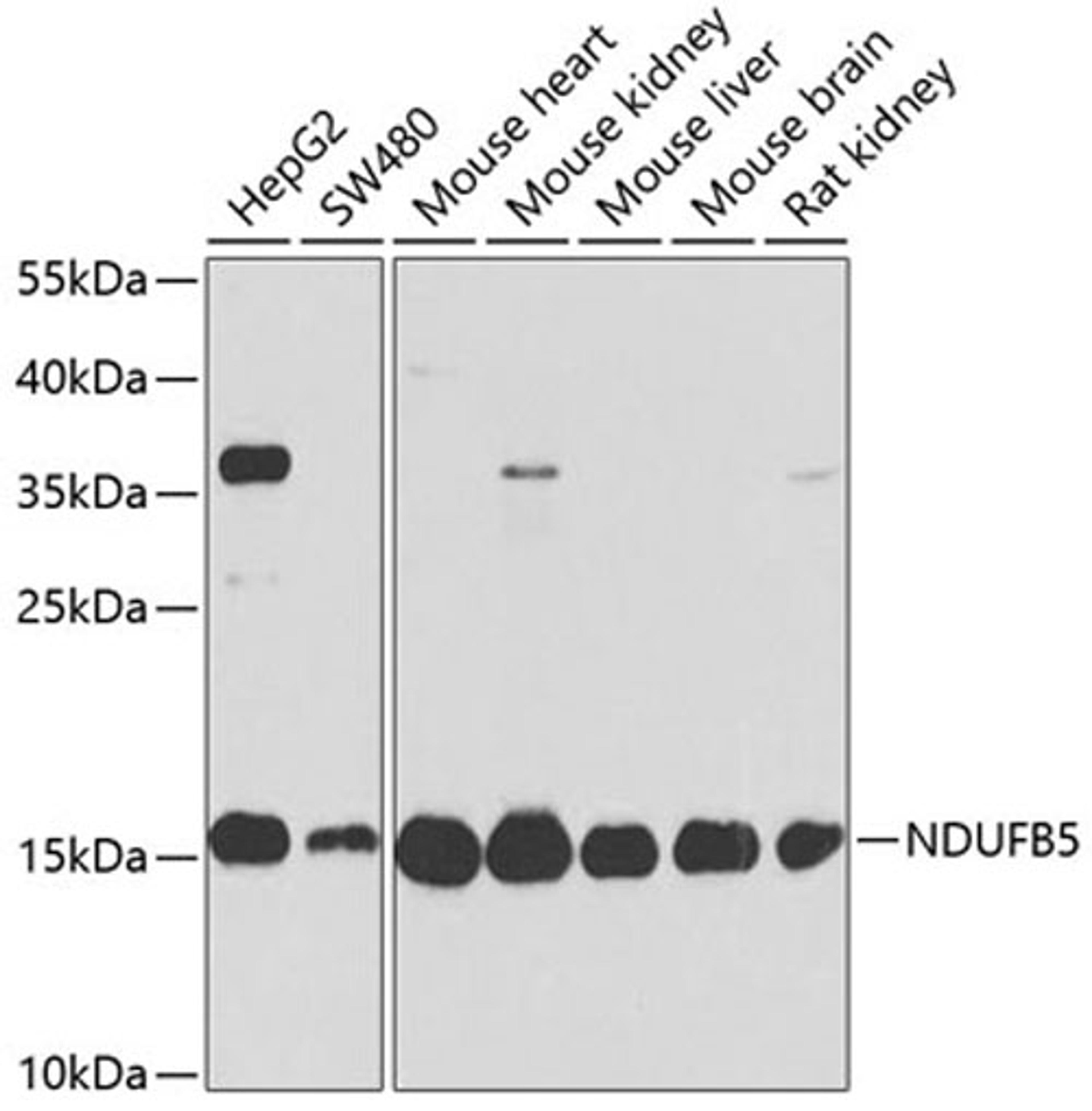 Western blot - NDUFB5 antibody (A14752)