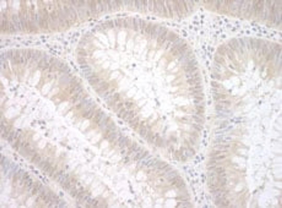 Detection of human TDP2 by immunohistochemistry.