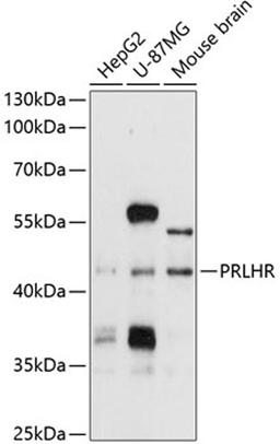 Western blot - PRLHR antibody (A10479)