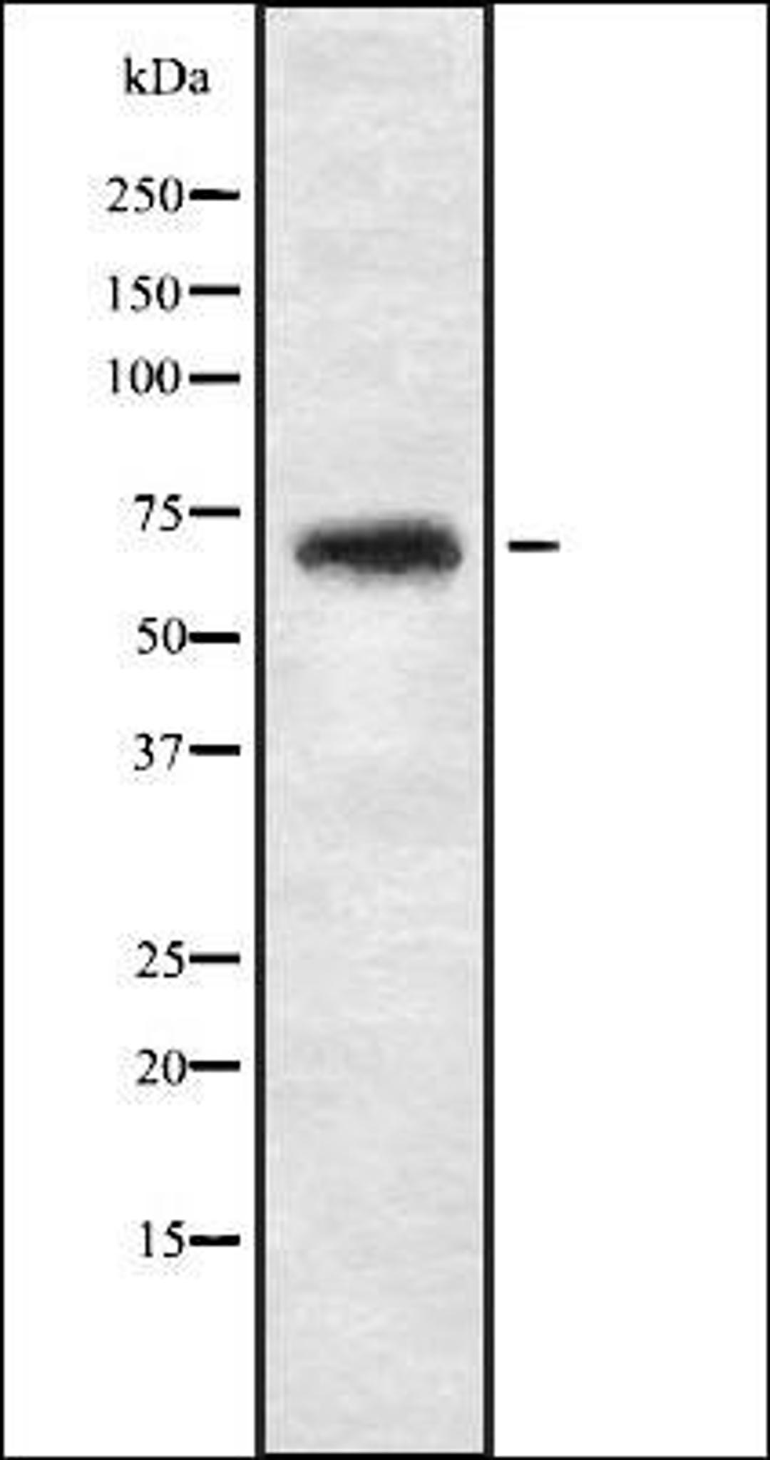 Western blot analysis of 293T whole cell lysate using NBPF4 antibody