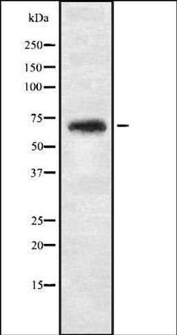 Western blot analysis of 293T whole cell lysate using NBPF4 antibody