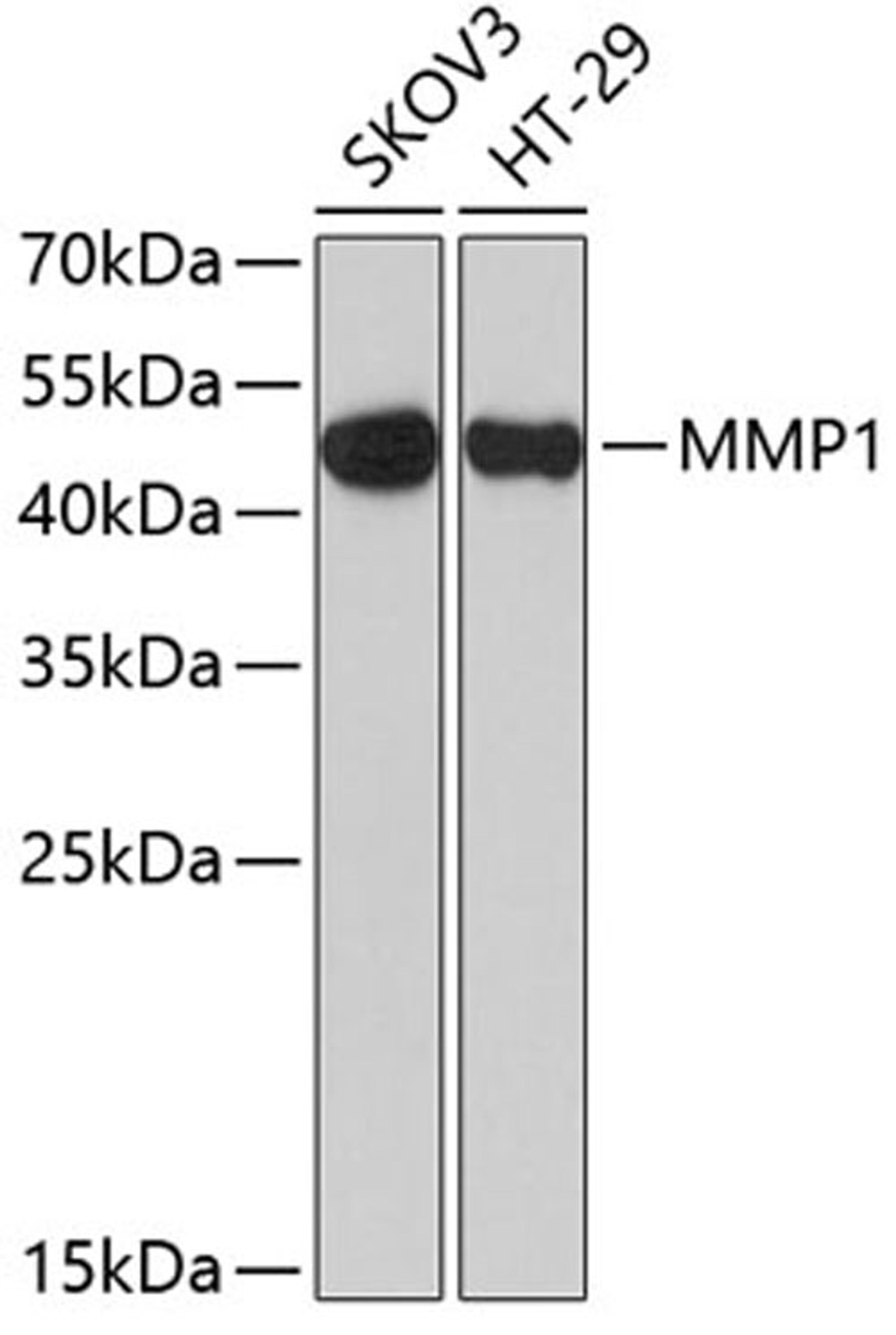 Western blot - MMP1 antibody (A1191)