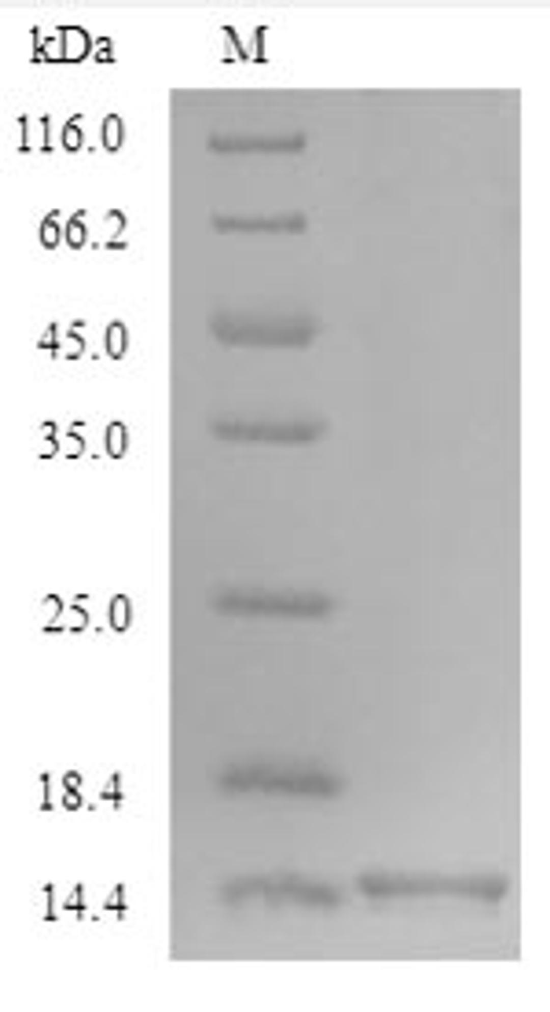 (Tris-Glycine gel) Discontinuous SDS-PAGE (reduced) with 5% enrichment gel and 15% separation gel.