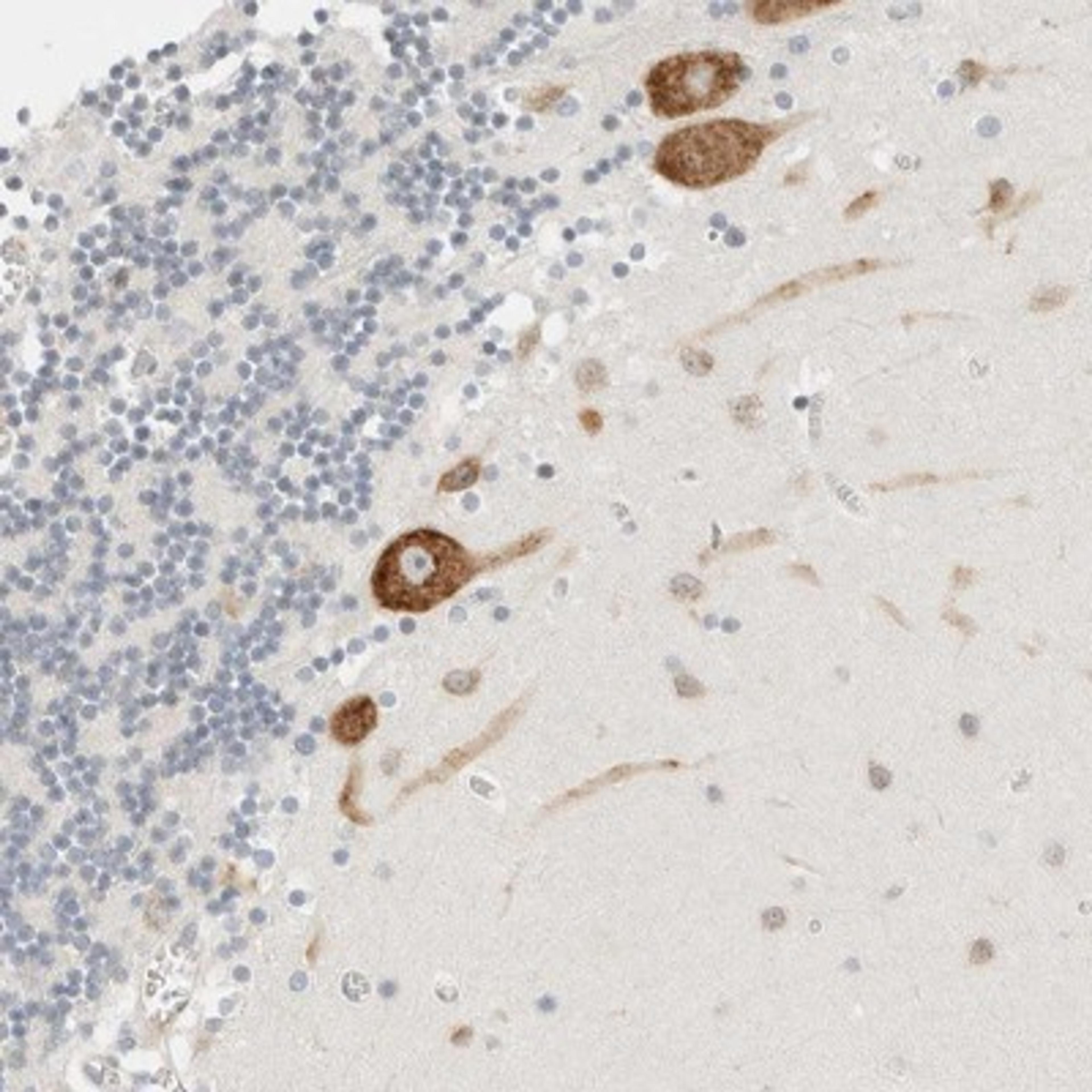 Immunohistochemistry-Paraffin: C1orf124 Antibody [NBP1-84163] - Staining of human cerebellum shows distinct cytoplasmic positivity in purkinje cells.