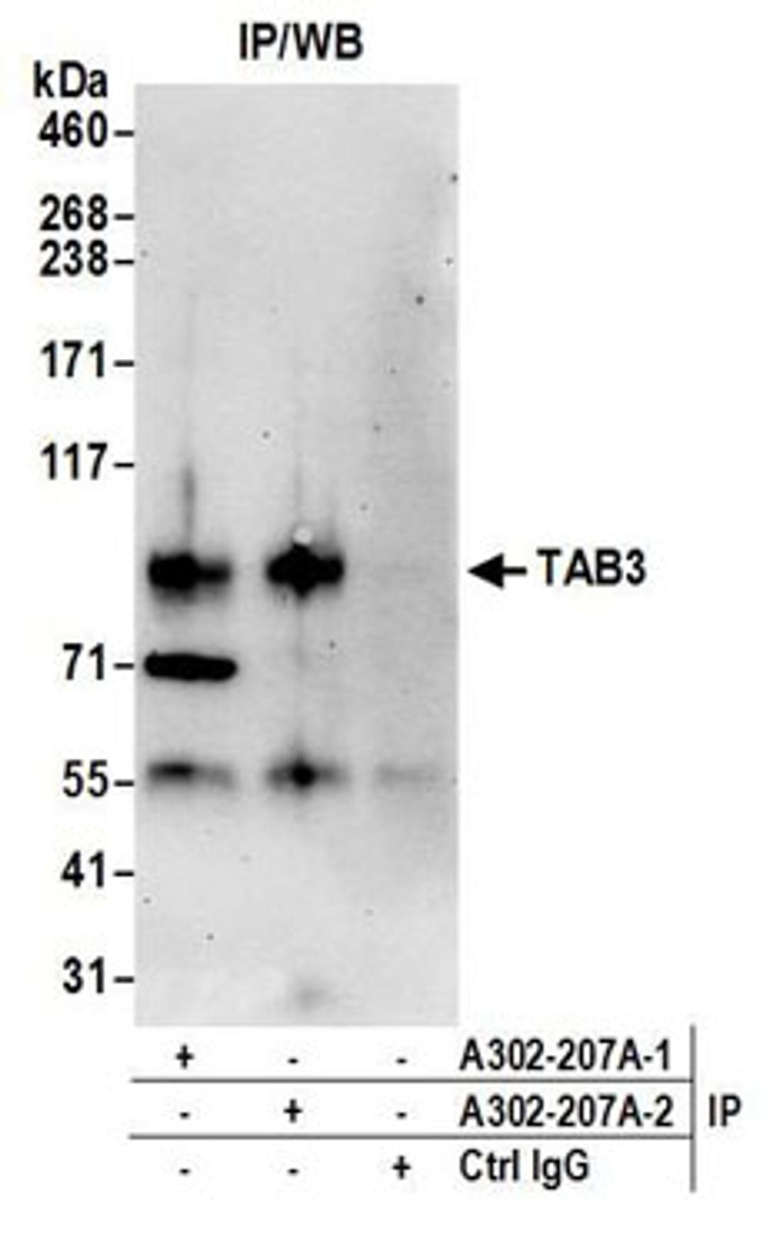 Detection of human TAB3 by western blot of immunoprecipitates.