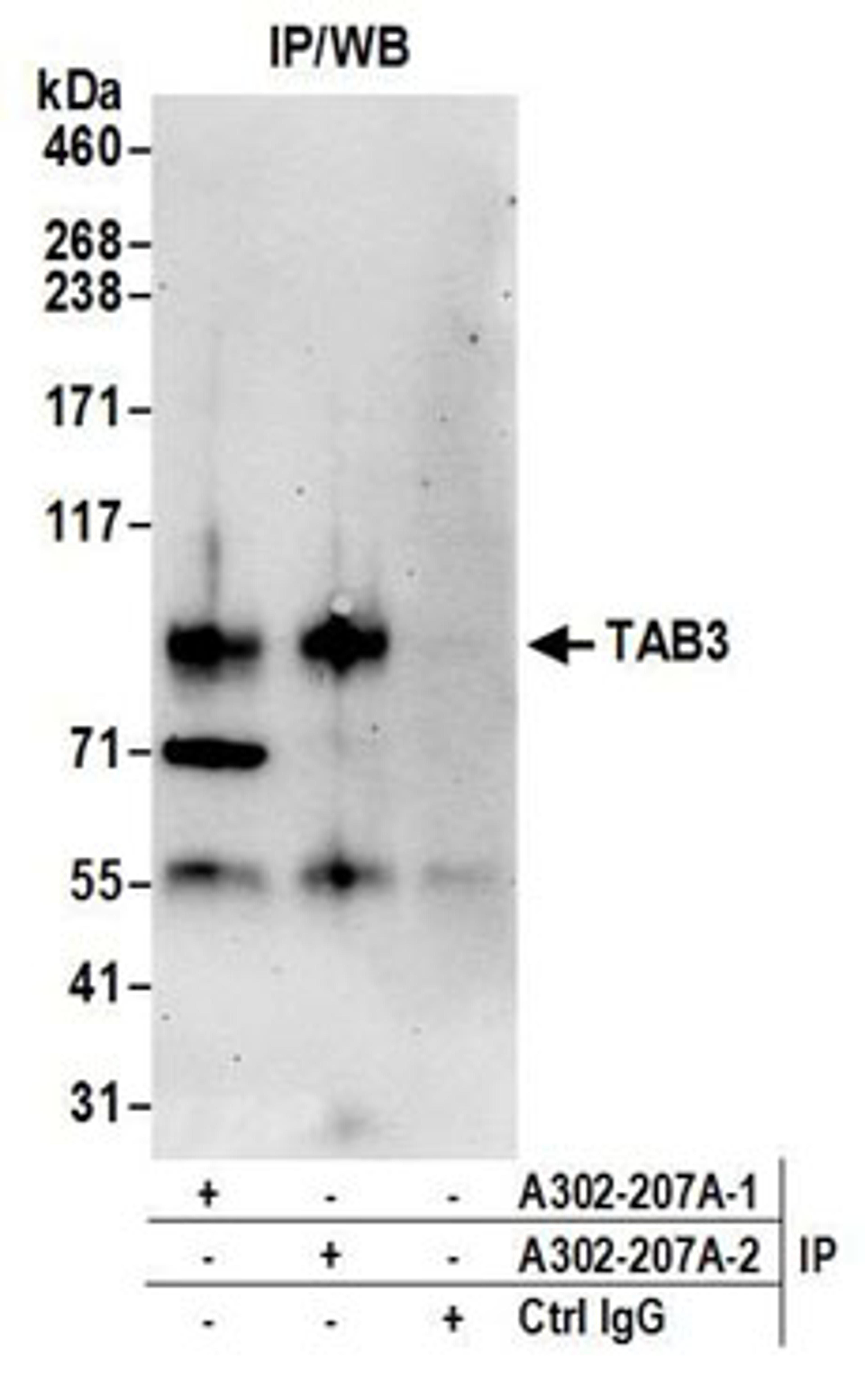 Detection of human TAB3 by western blot of immunoprecipitates.