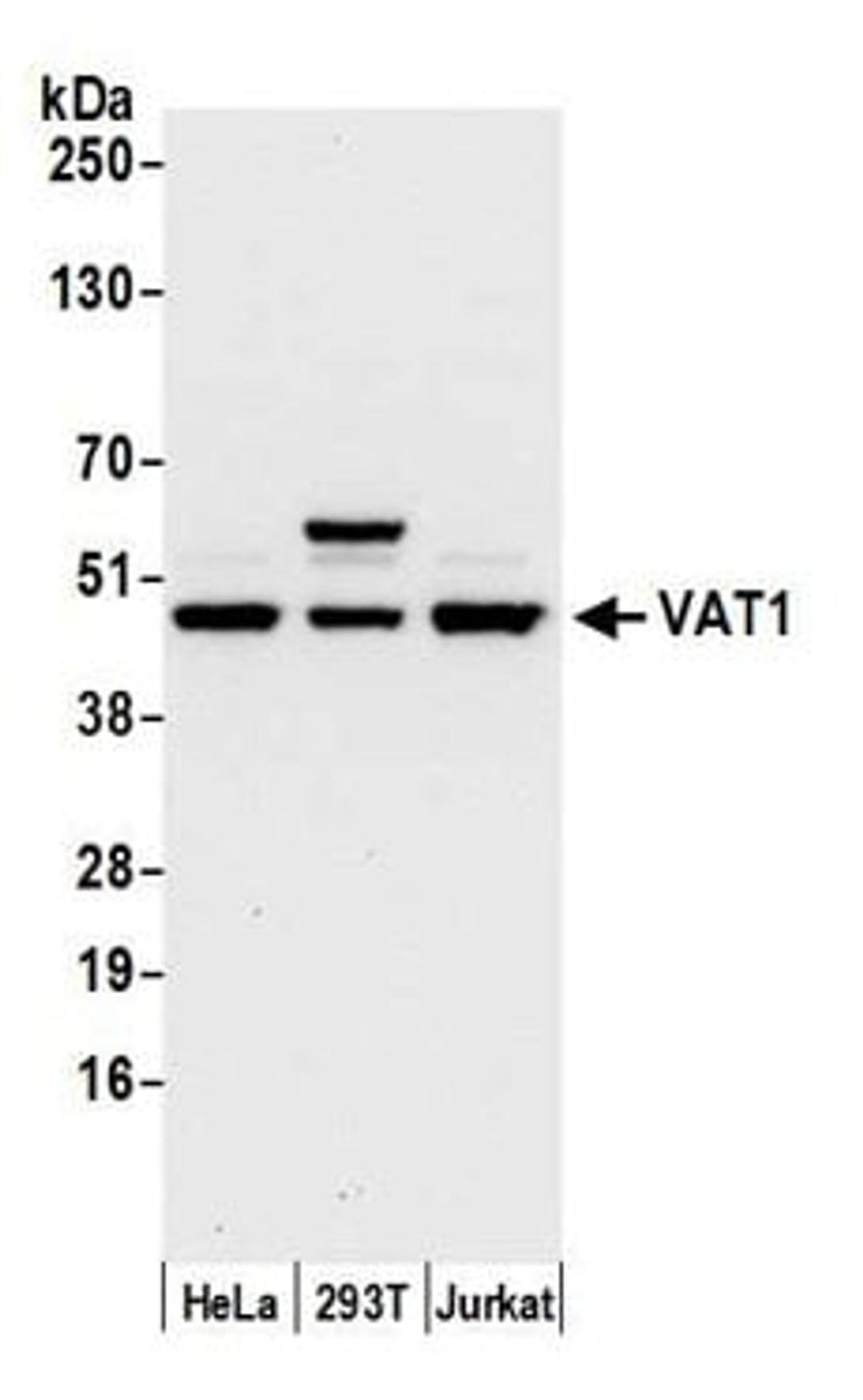 Detection of human VAT1 by western blot.