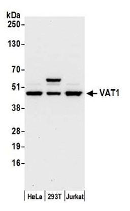 Detection of human VAT1 by western blot.