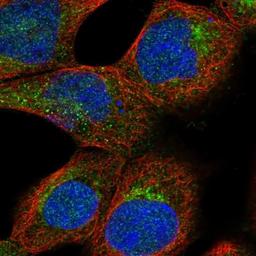 Immunocytochemistry/Immunofluorescence: Deoxycytidylate deaminase Antibody [NBP1-87424] - Staining of human cell line A-431 shows positivity in nucleus but not nucleoli, cytoplasm & golgi apparatus.