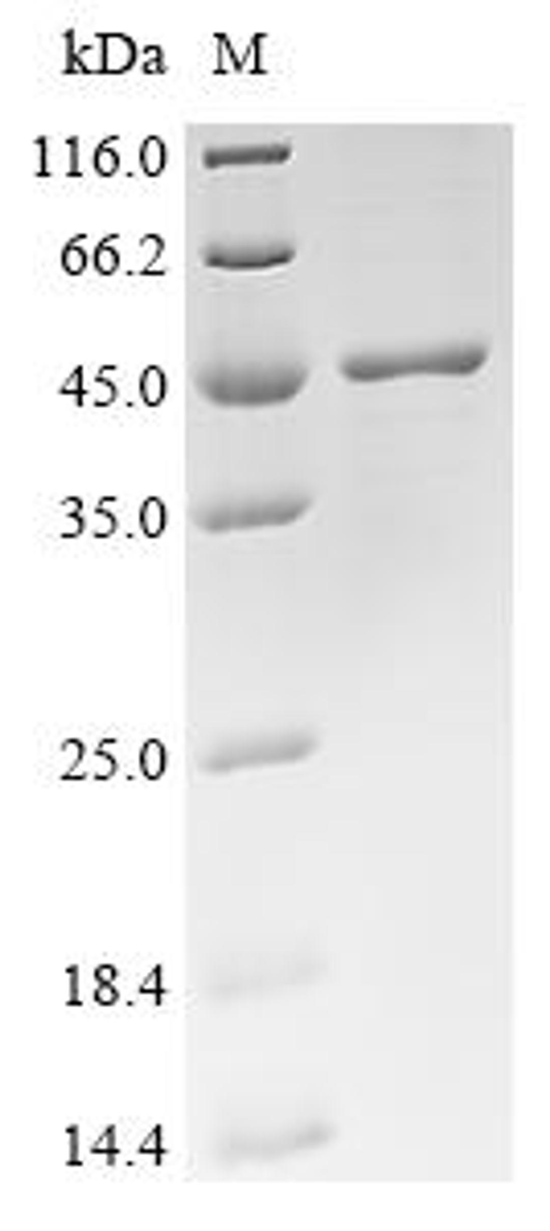 (Tris-Glycine gel) Discontinuous SDS-PAGE (reduced) with 5% enrichment gel and 15% separation gel.