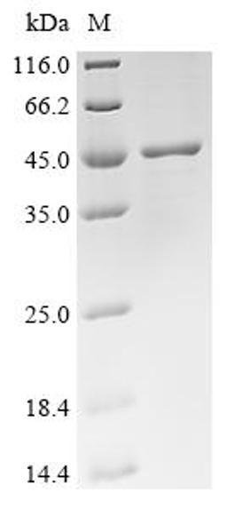 (Tris-Glycine gel) Discontinuous SDS-PAGE (reduced) with 5% enrichment gel and 15% separation gel.
