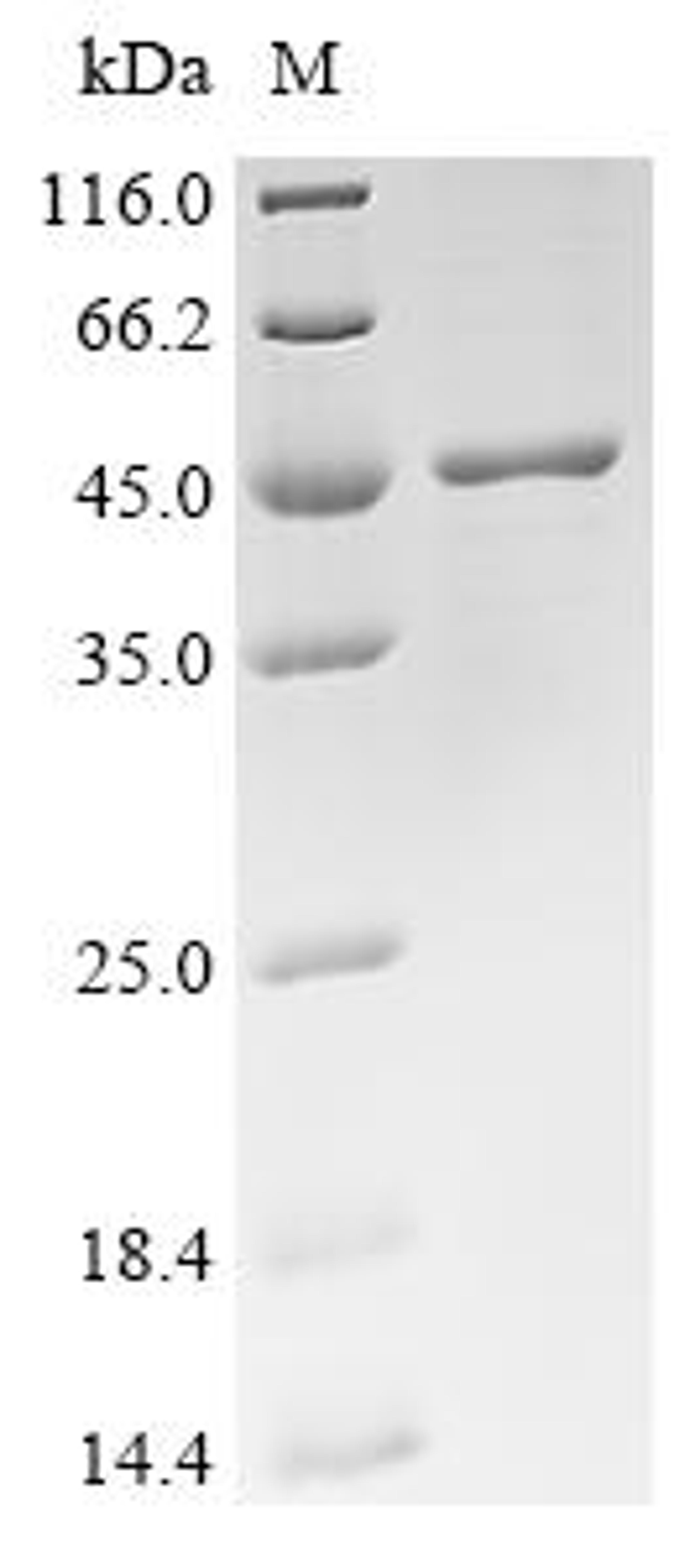 (Tris-Glycine gel) Discontinuous SDS-PAGE (reduced) with 5% enrichment gel and 15% separation gel.