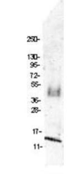 Western blot analysis of membrane was blocked with 3% BSA (BSA-30, diluted 1:10), and probed with 4 ug/mL using MIP 1 beta antibody