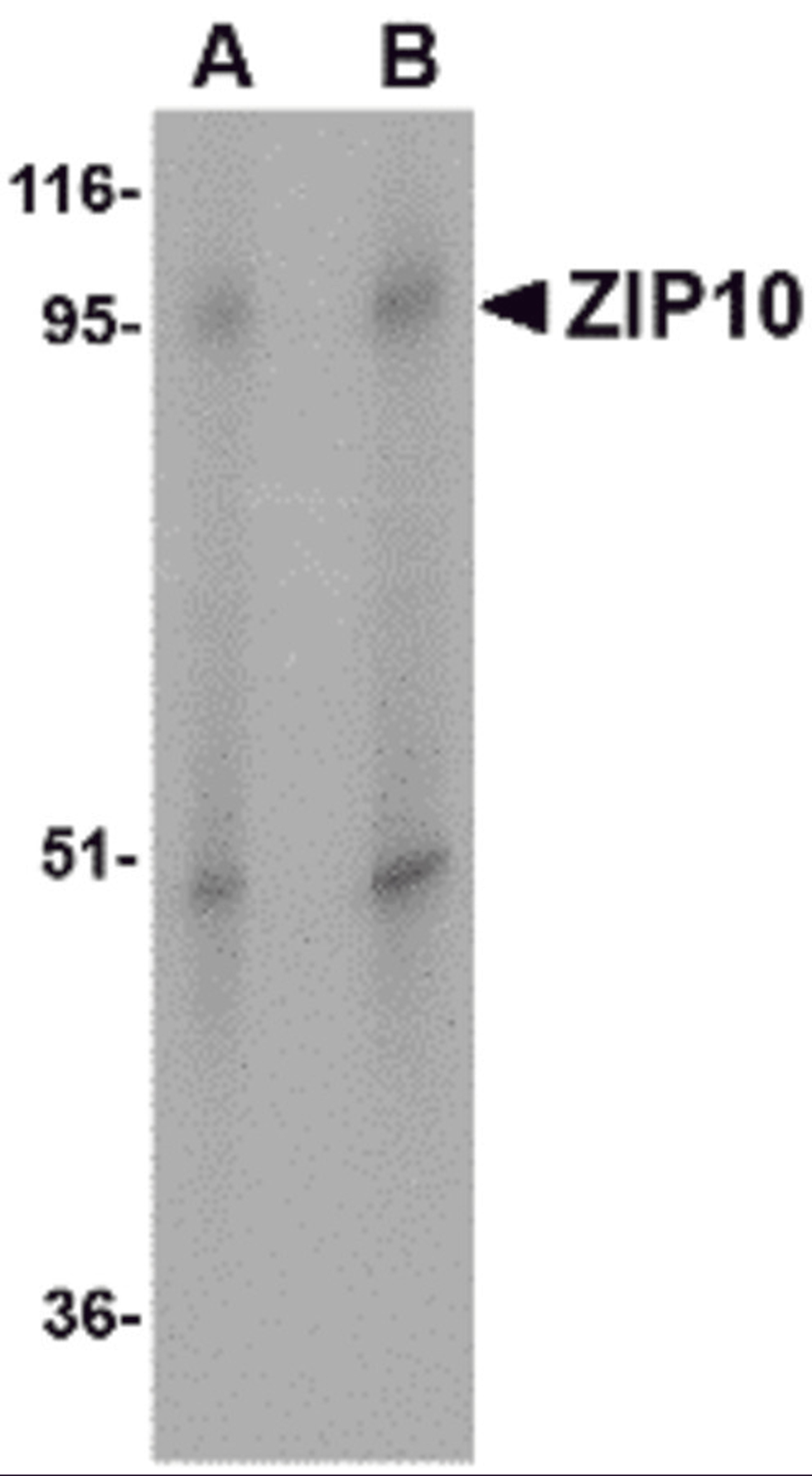 Western blot analysis of ZIP10 in human spleen tissue lysate with ZIP10 antibody at (A) 1 and (B) 2 &#956;g/mL.