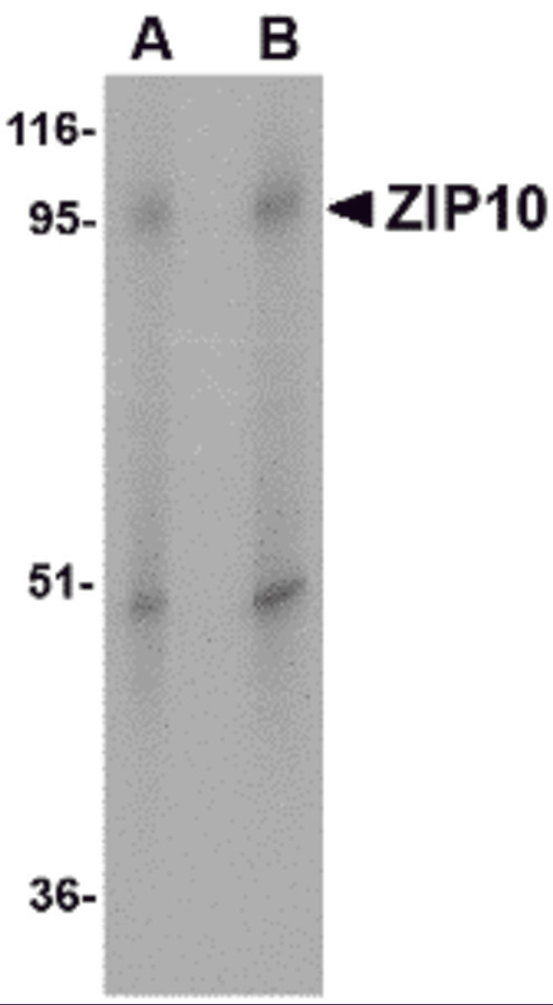 Western blot analysis of ZIP10 in human spleen tissue lysate with ZIP10 antibody at (A) 1 and (B) 2 μg/mL.