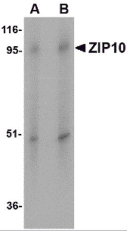 Western blot analysis of ZIP10 in human spleen tissue lysate with ZIP10 antibody at (A) 1 and (B) 2 μg/mL.