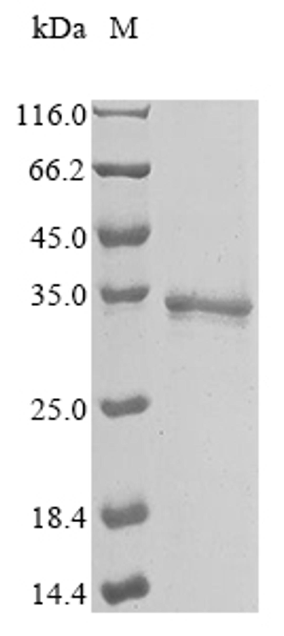 (Tris-Glycine gel) Discontinuous SDS-PAGE (reduced) with 5% enrichment gel and 15% separation gel.