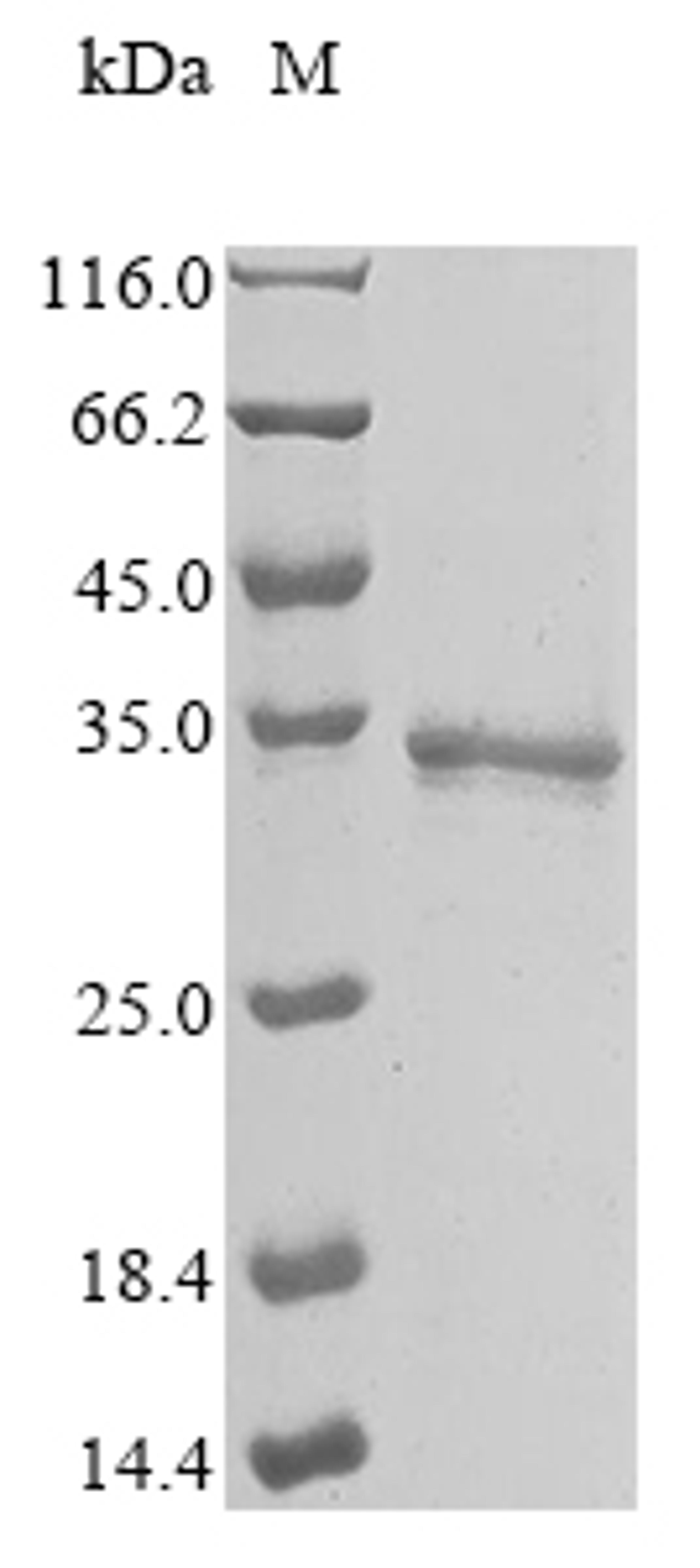 (Tris-Glycine gel) Discontinuous SDS-PAGE (reduced) with 5% enrichment gel and 15% separation gel.