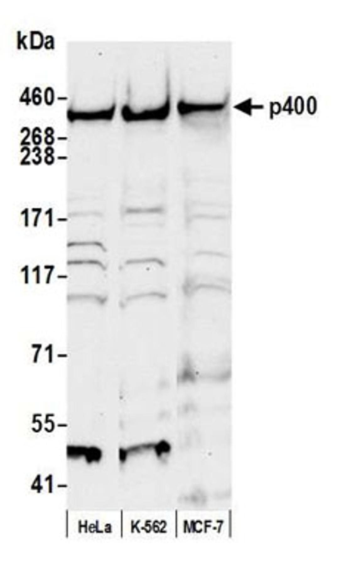 Detection of human p400 by western blot.