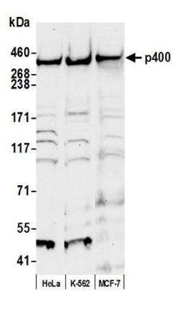 Detection of human p400 by western blot.