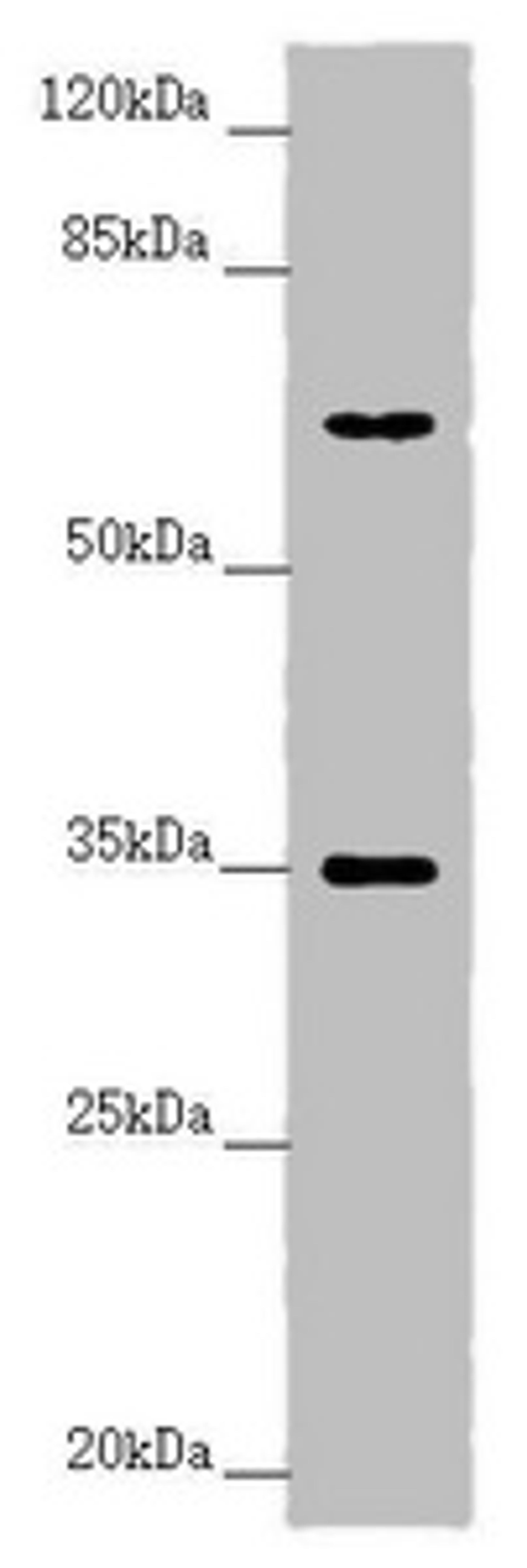 Western blot. All lanes: TRIM23 antibody at 4.55 ug/ml + Raw264.7 whole cell lysate. Secondary. Goat polyclonal to rabbit IgG at 1/10000 dilution. Predicted band size: 65, 64, 62 kDa. Observed band size: 65, 35 kDa.
