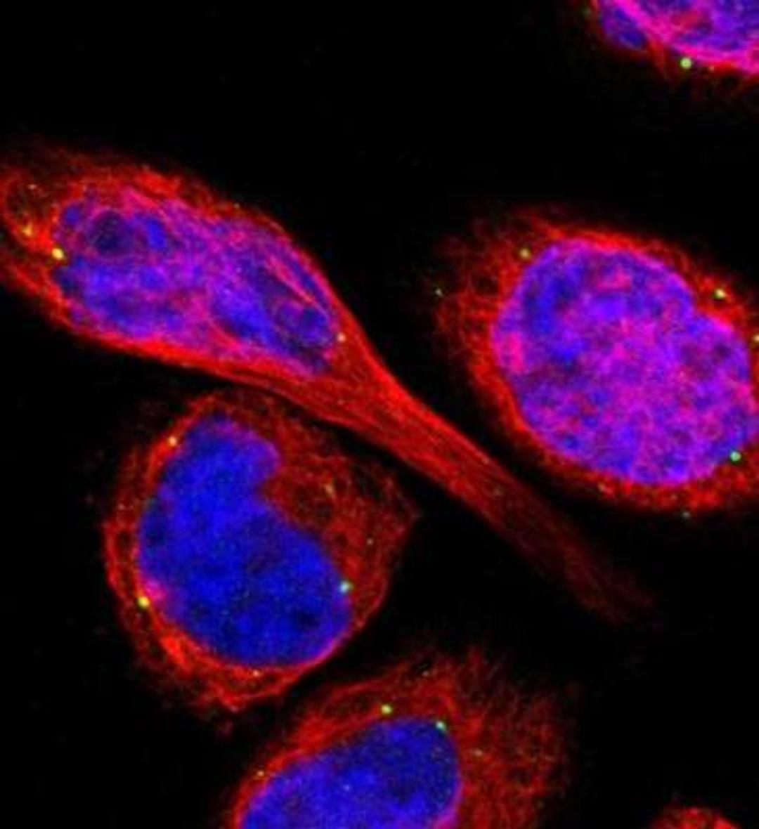 Immunocytochemistry/Immunofluorescence: TMEM25 Antibody [NBP1-82237] - Staining of human cell line A-431 shows positivity in vesicles.