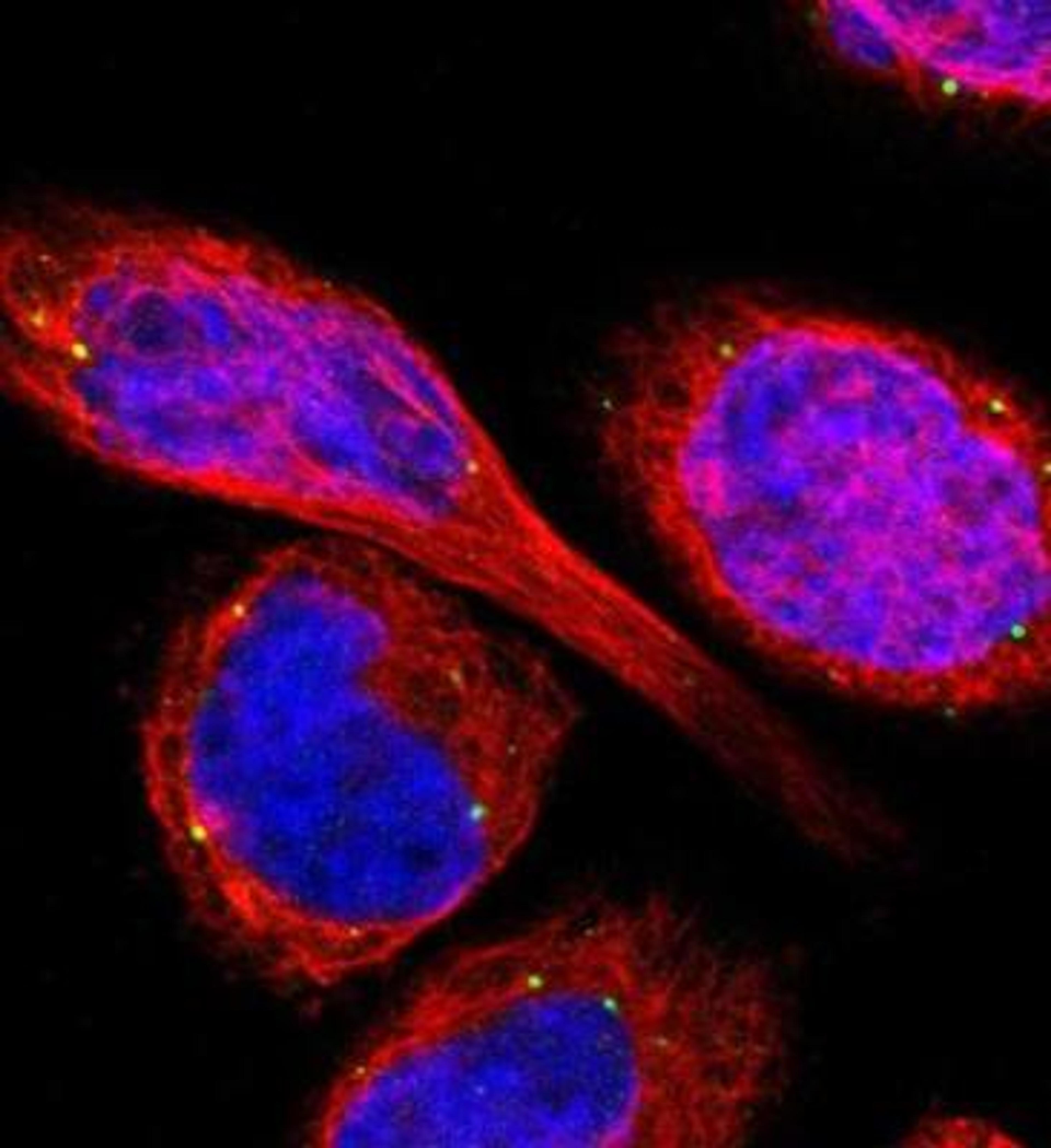 Immunocytochemistry/Immunofluorescence: TMEM25 Antibody [NBP1-82237] - Staining of human cell line A-431 shows positivity in vesicles.