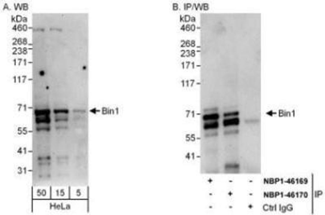 Western Blot: BIN1 Antibody [NBP1-46170] - Whole cell lysate (5, 15 and 50 mcg for WB; 1 mg for IP, 20% of IP loaded) from HeLa cells.  Antibodies: Affinity purified rabbit anti-Bin1 antibody  used for WB at 0.1 mcg/ml (A) and 1 mcg/ml (B) and used for IP at 3 mcg/mg lysate.  Bin1 was also immunoprecipitated by rabbit anti-Bin1 antibody NBP1-46169, which recognizes an upstream epitope.