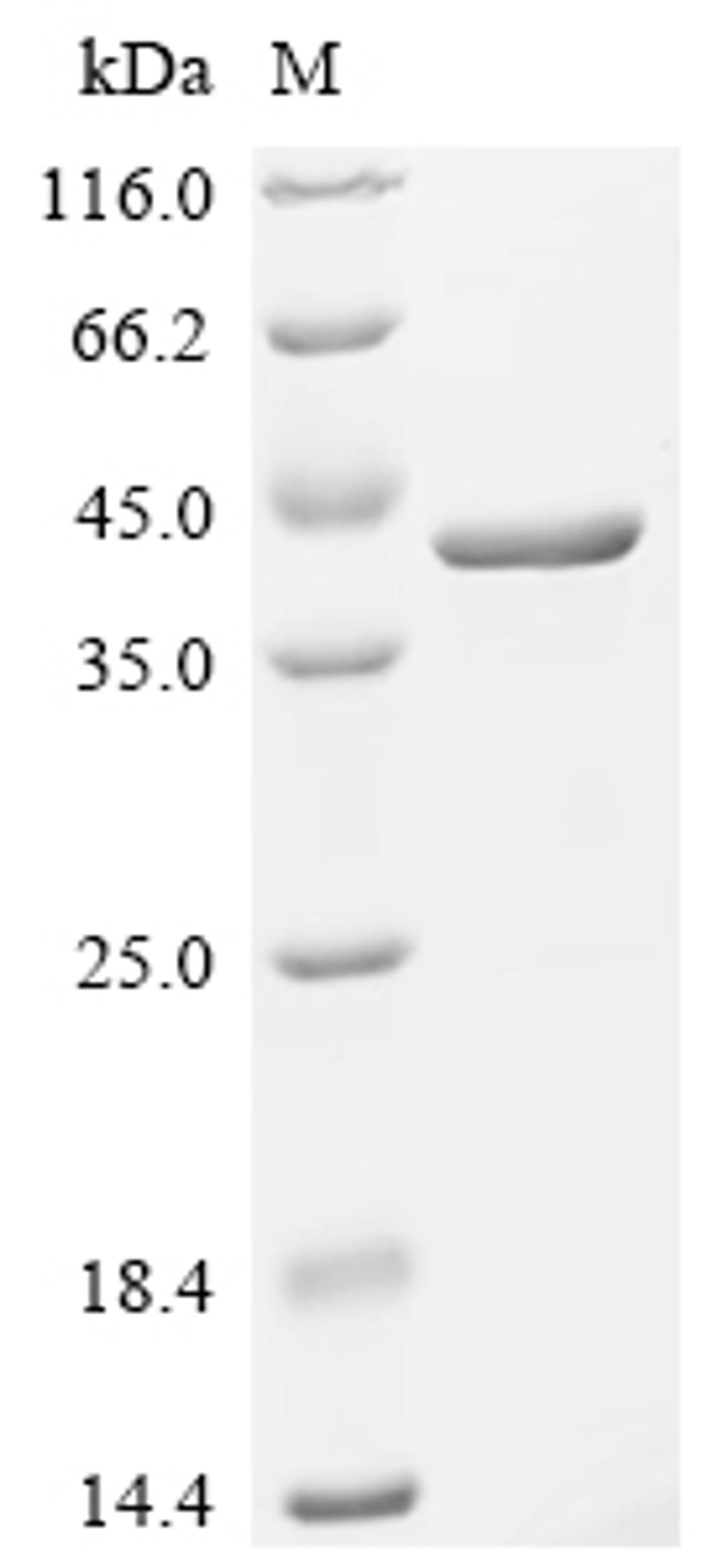 (Tris-Glycine gel) Discontinuous SDS-PAGE (reduced) with 5% enrichment gel and 15% separation gel.