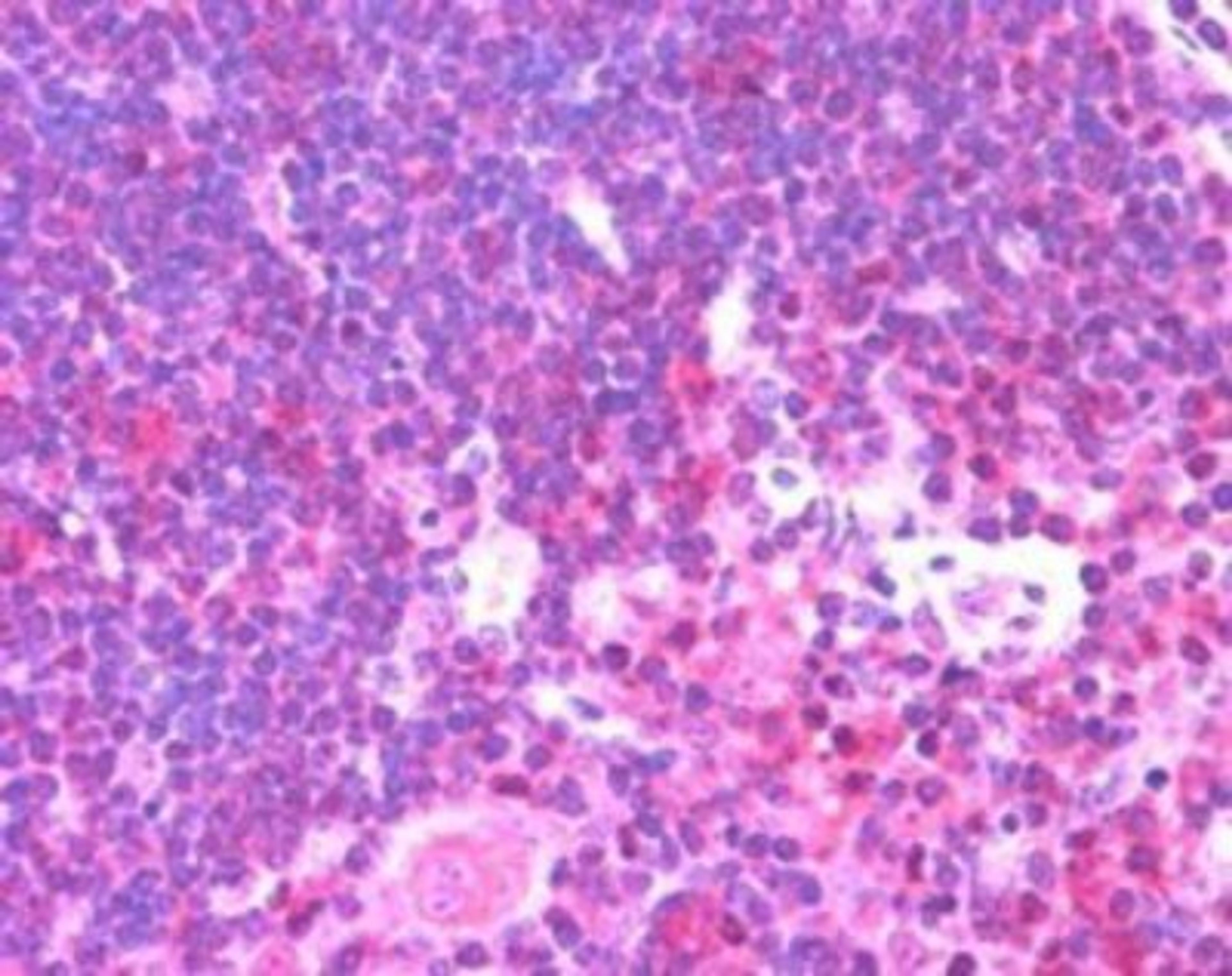 Immunohistochemistry-Paraffin: Munc 13-4 Antibody [NB100-41385] - (2.5ug/ml) staining of paraffin embedded Human Thymus. Steamed antigen retrieval with citrate buffer pH 6, AP-staining.