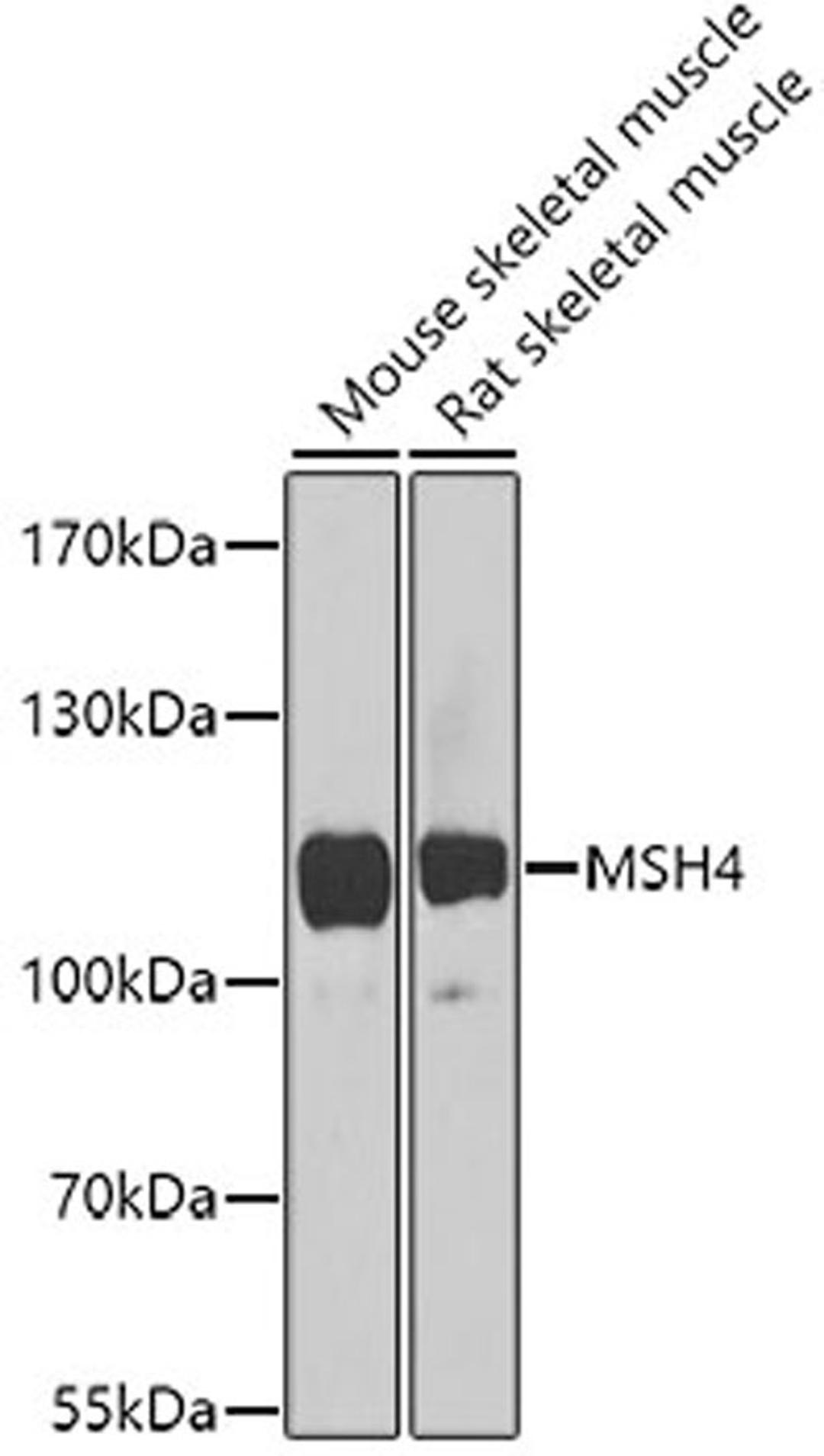 Western blot - MSH4 antibody (A8556)