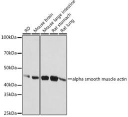 Western blot - alpha smooth muscle actin antibody (A1011)