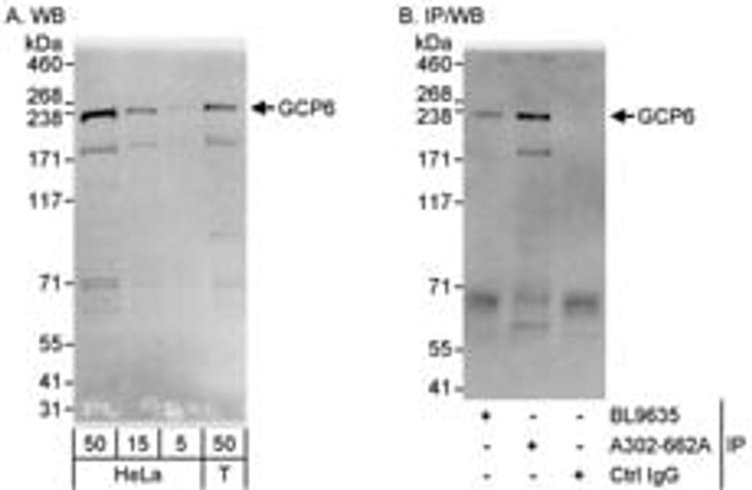 Detection of human GCP6 by western blot and immunoprecipitation.