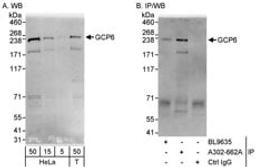 Detection of human GCP6 by western blot and immunoprecipitation.