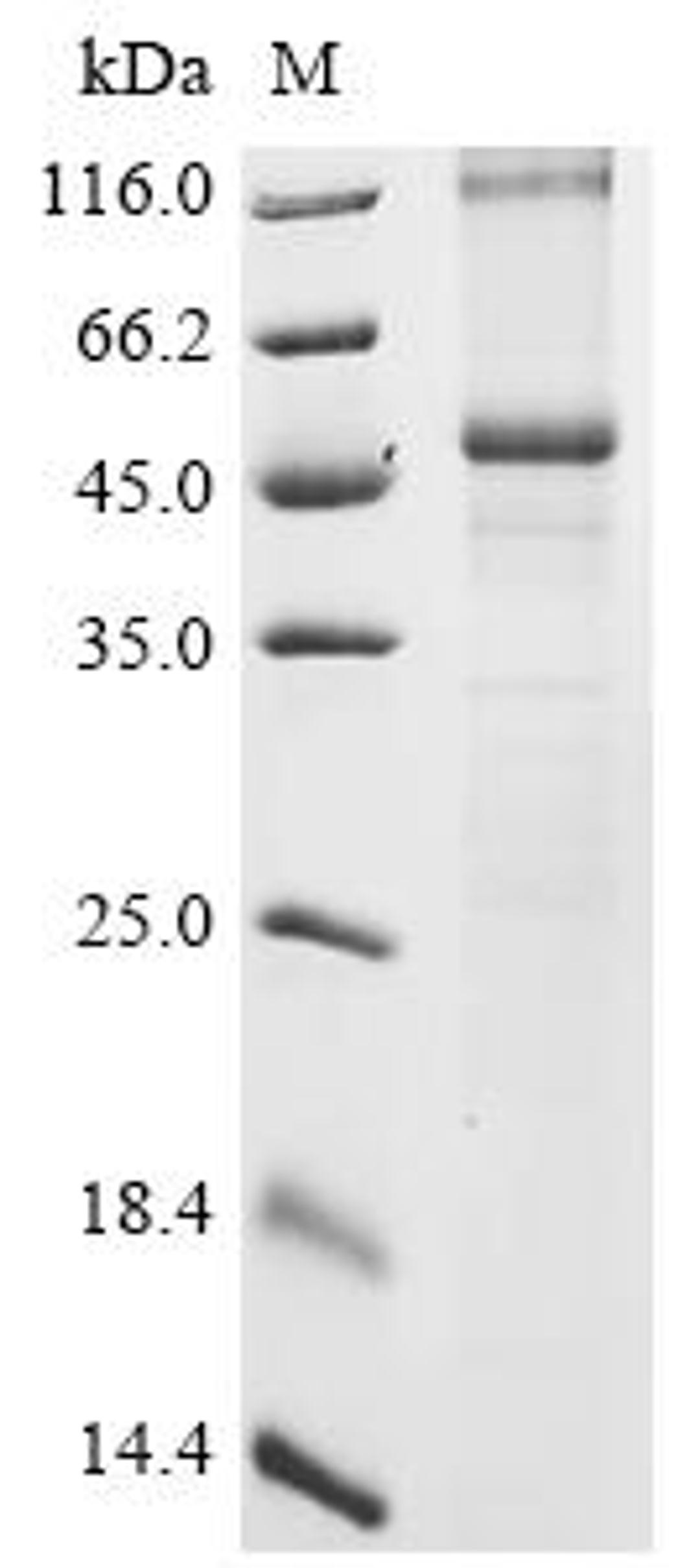 (Tris-Glycine gel) Discontinuous SDS-PAGE (reduced) with 5% enrichment gel and 15% separation gel.