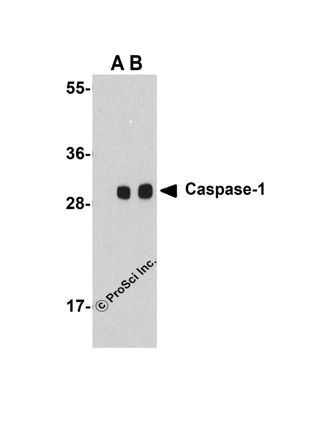 Western blot analysis of Caspase-1 in human heart cell lysate with Caspase-1 antibody at (A) 1 and (B) 2 μg/mL.