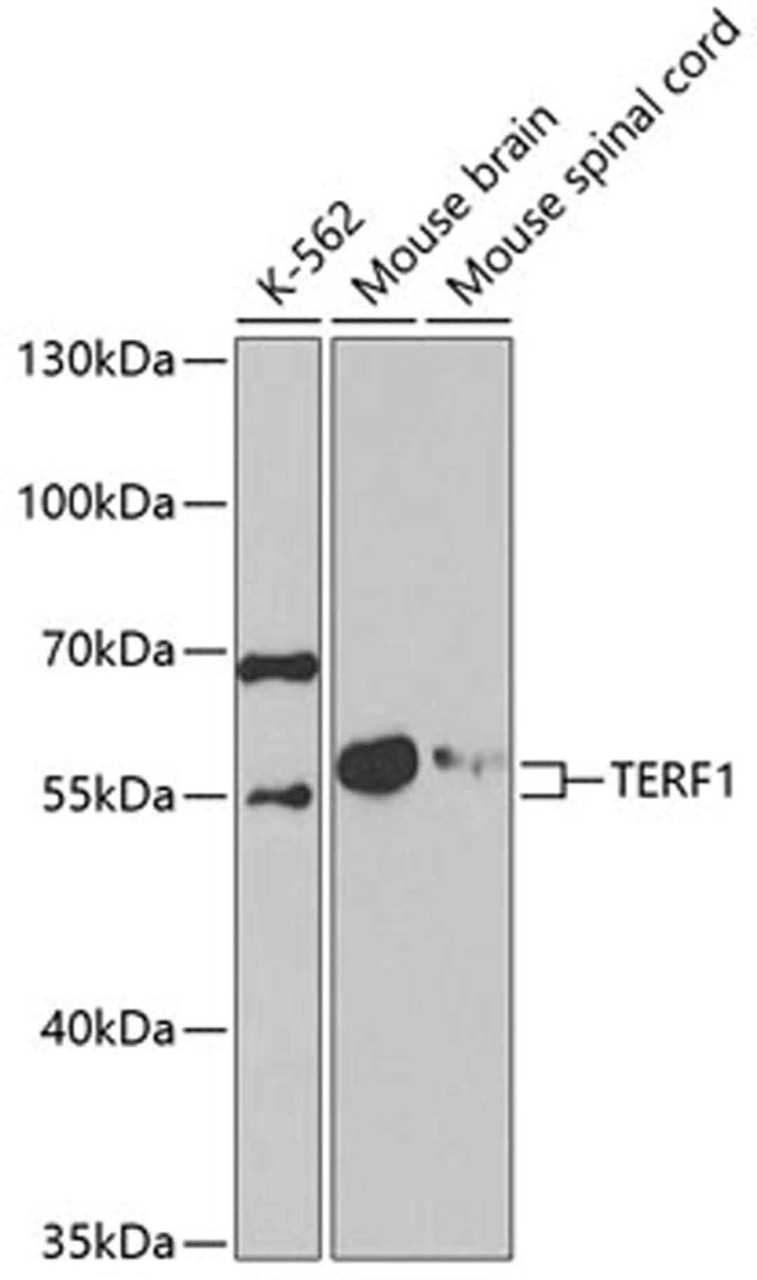 Western blot - TERF1 antibody (A5293)