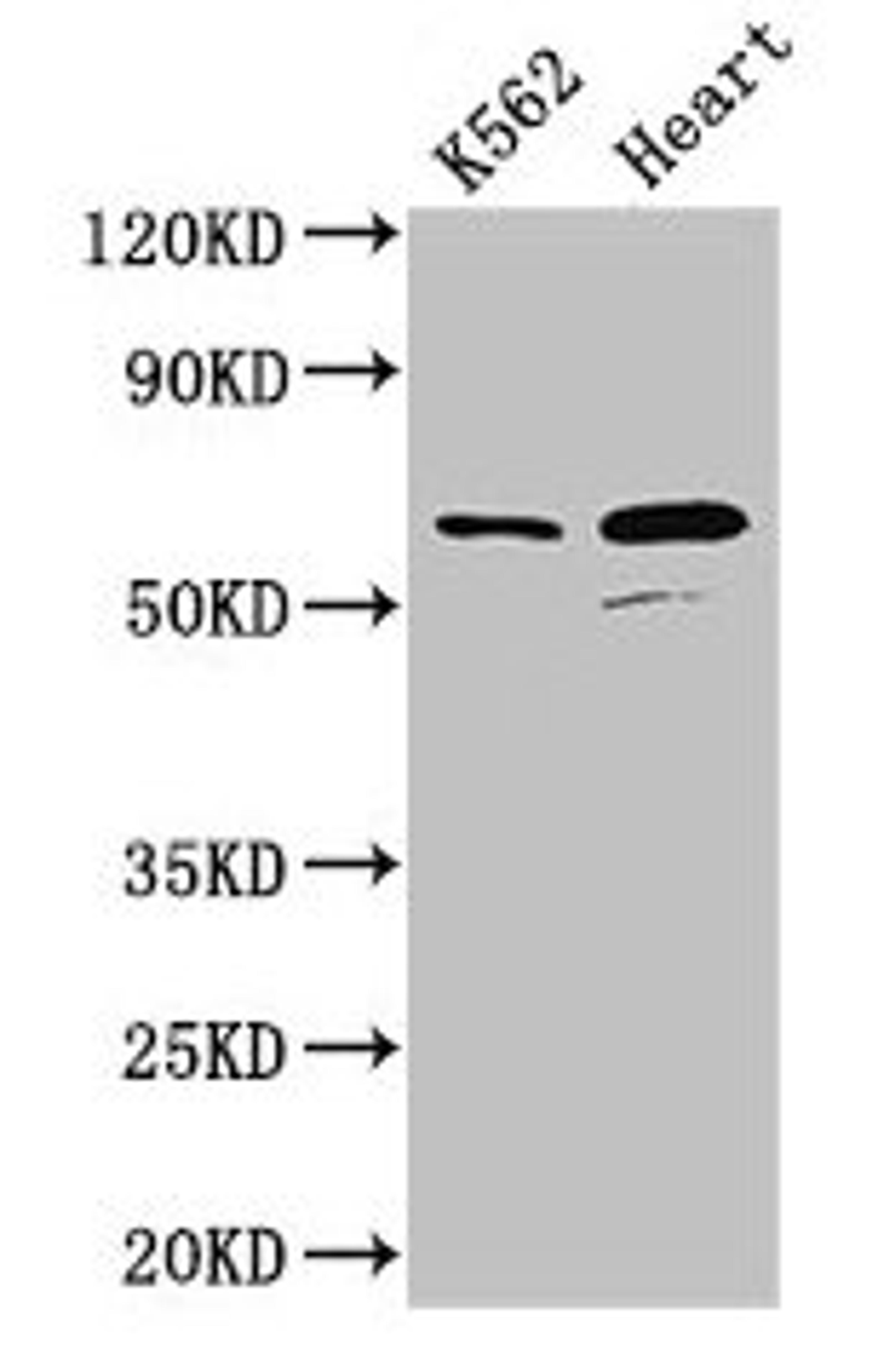 Western Blot. Positive WB detected in: K562 whole cell lysate, Mouse heart tissue. All lanes: ATP5F1A antibody at 2.5ug/ml. Secondary. Goat polyclonal to rabbit IgG at 1/50000 dilution. Predicted band size: 60, 55, 58 kDa. Observed band size: 60 kDa. 