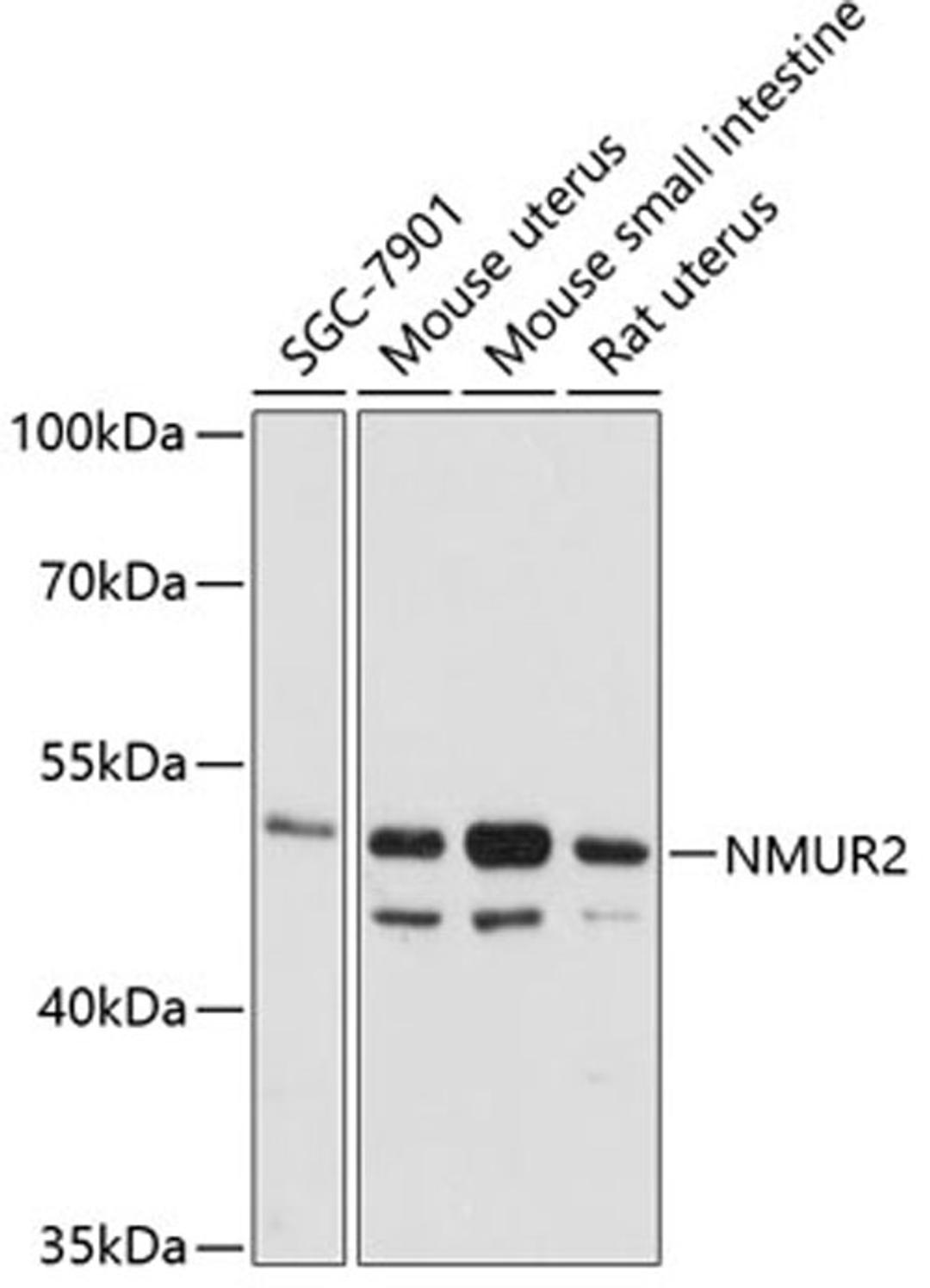 Western blot - NMUR2 antibody (A12812)