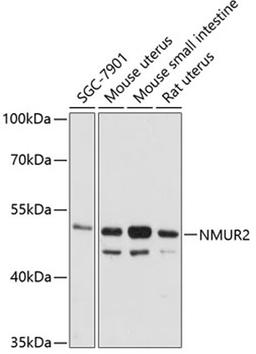 Western blot - NMUR2 antibody (A12812)