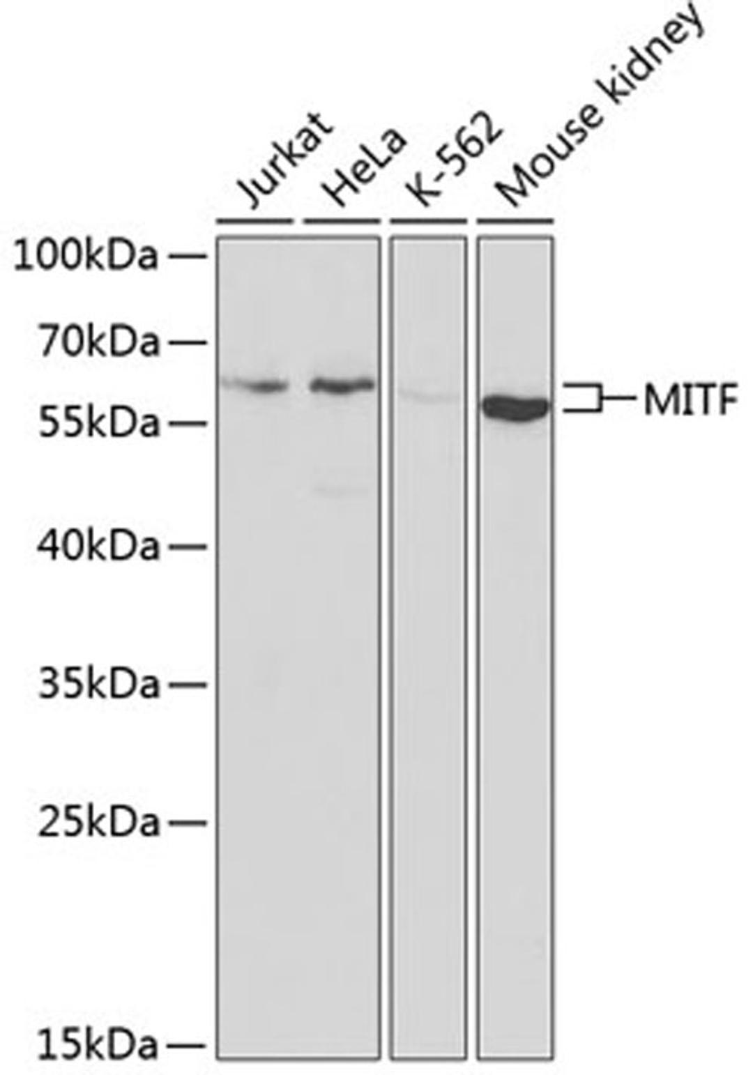 Western blot - MITF antibody (A1255)