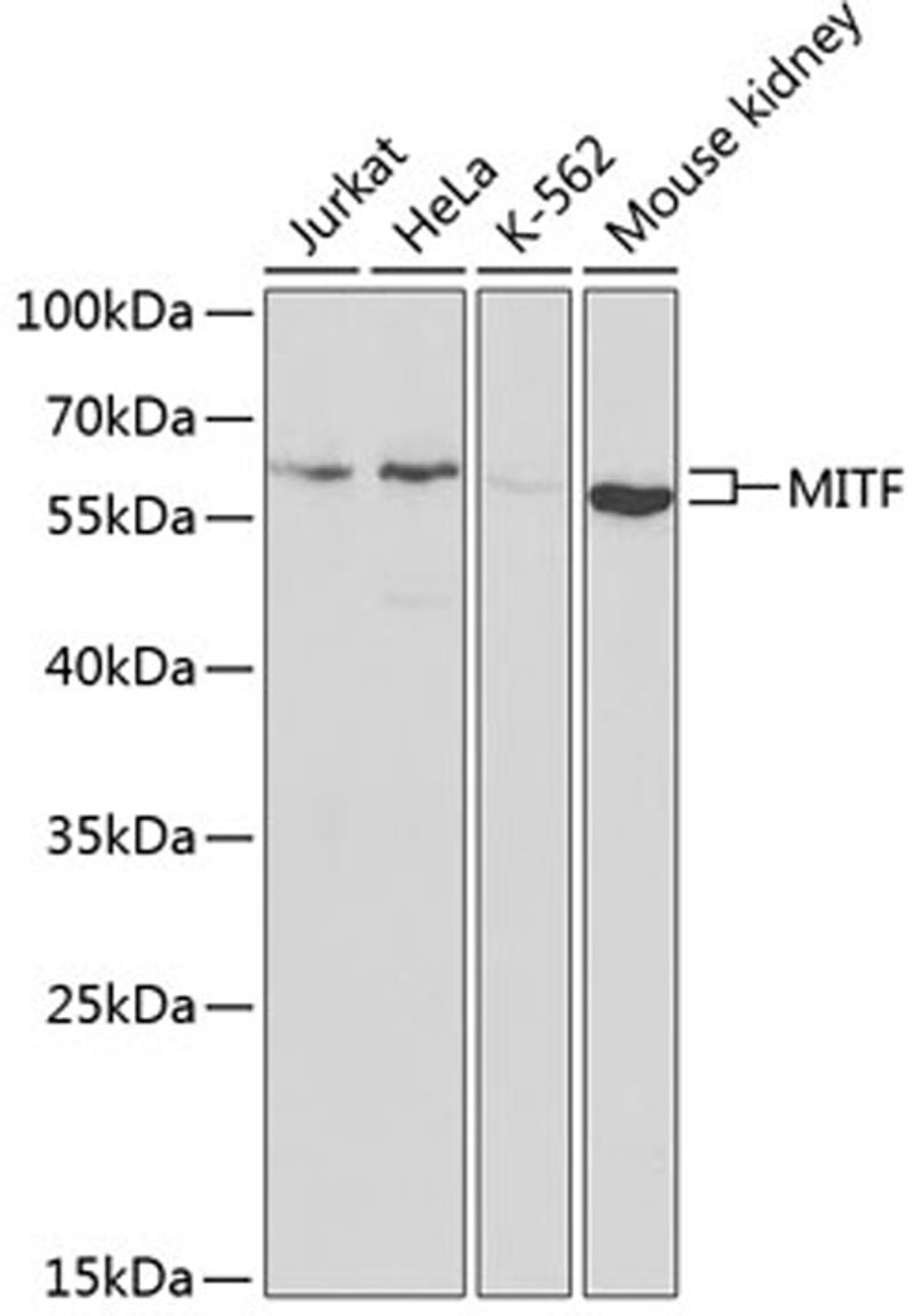 Western blot - MITF antibody (A1255)