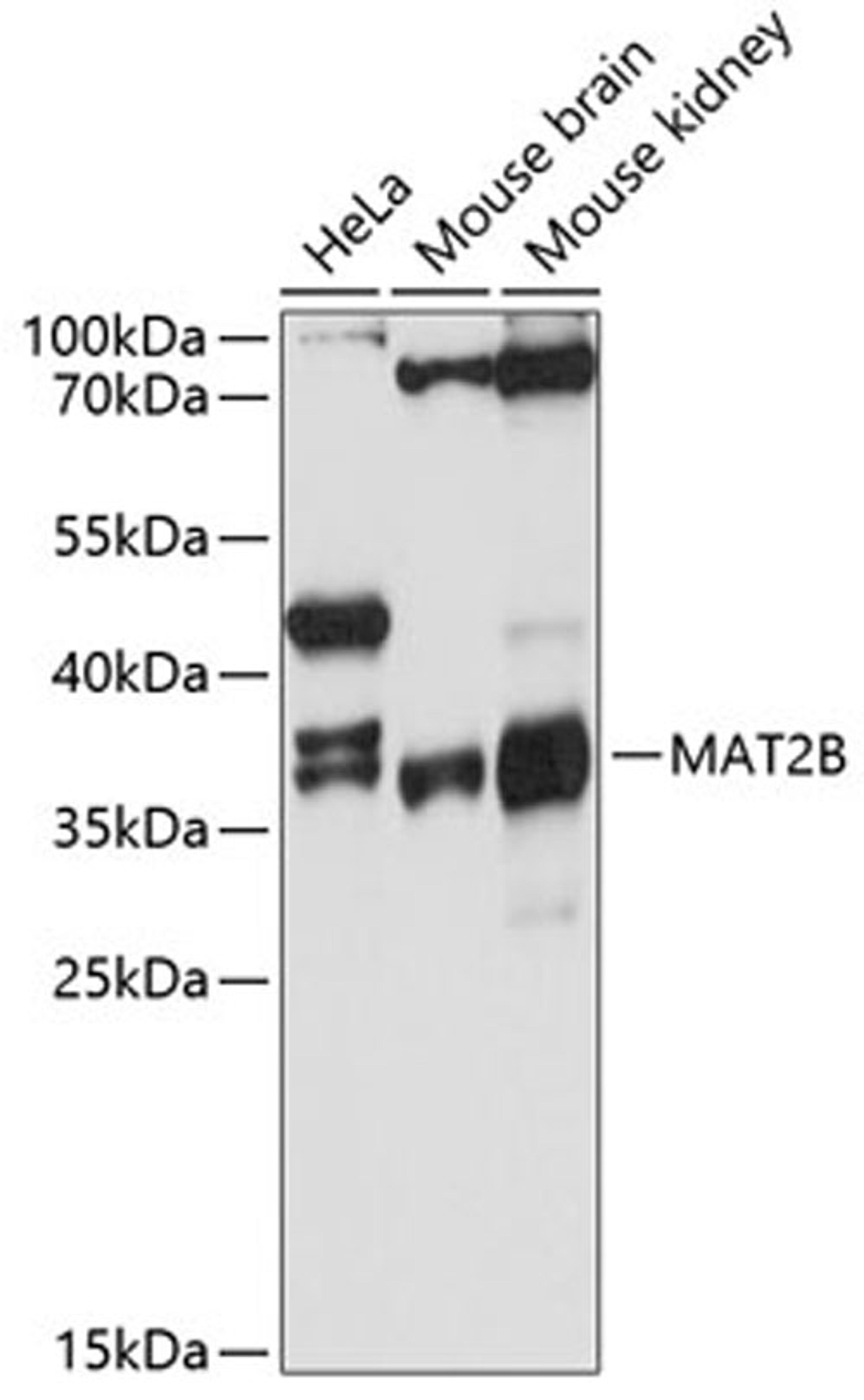 Western blot - MAT2B antibody (A11608)