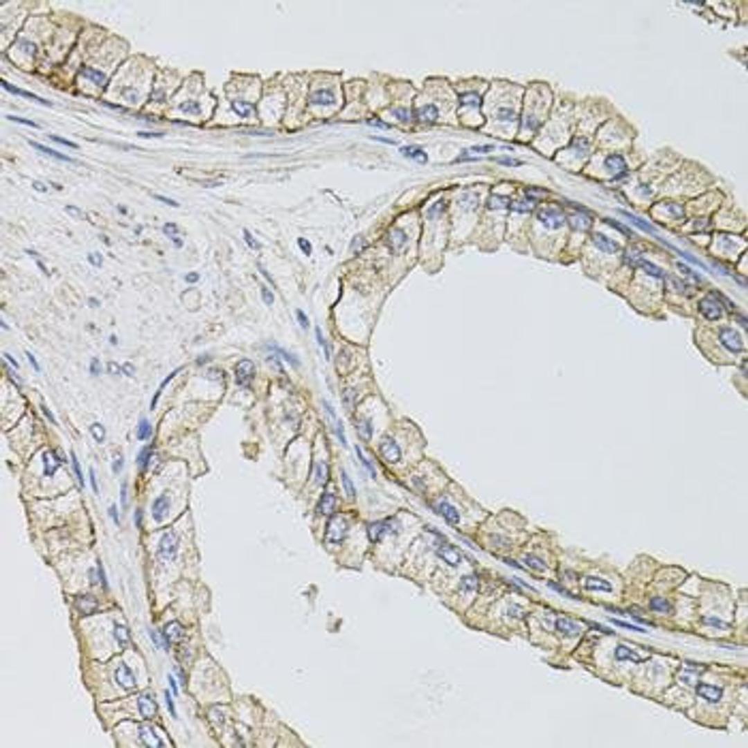 Immunohistochemical staining of mouse kidney tissue using SLC1A4 antibody