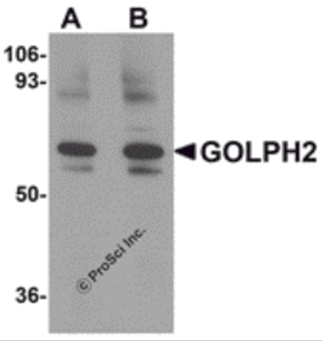 Western blot analysis of GOLPH2 in rat brain tissue lysate with GOLPH2 antibody at (A) 0.25 and (B) 0.5 &#956;g/mL.